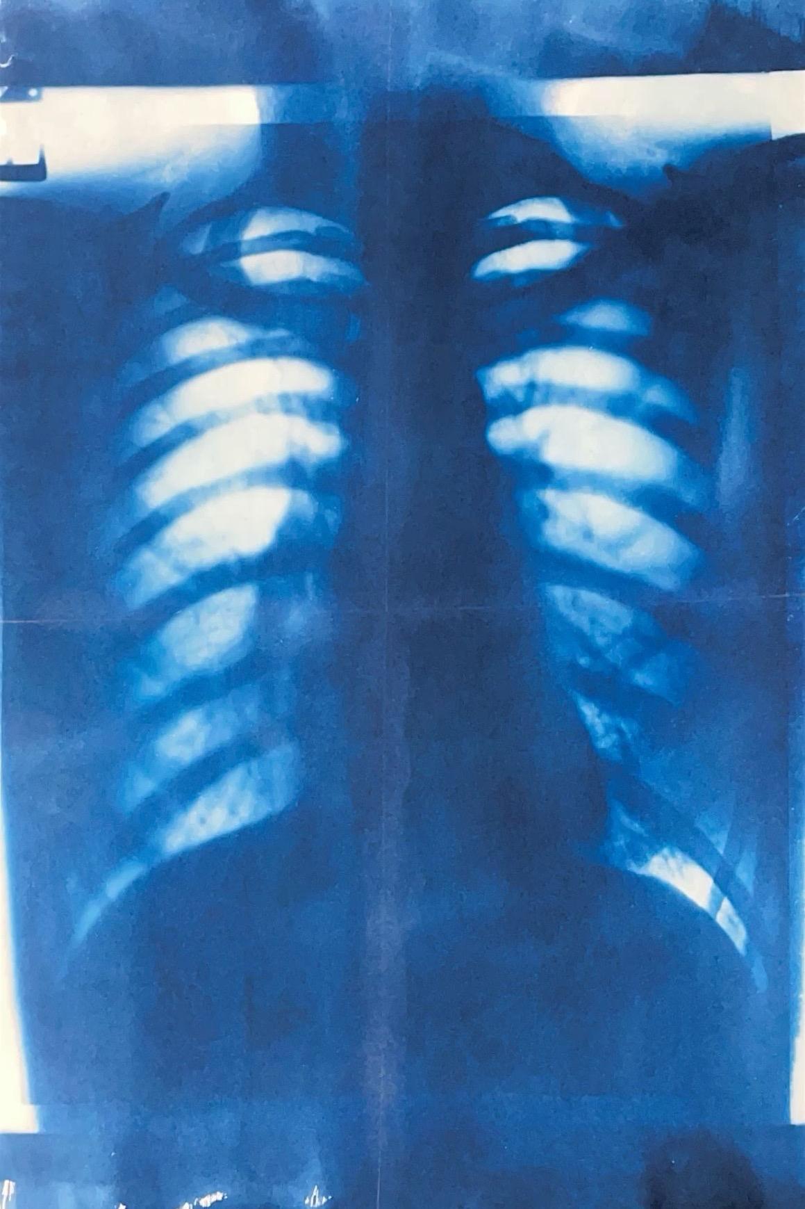 TRAPEZA: BROKEN HEART CLUB